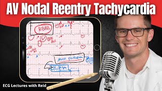 AV Nodal Reentry Tachycardia AVNRT EKG  ECG Lecture [upl. by Adda280]