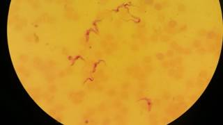 Trypanosoma gambiense trypomastigote [upl. by Sura]