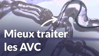 Une fibre biomédicale étudie les caillots sanguins pour comprendre les causes dun AVC  Reportage [upl. by Ahsimin]