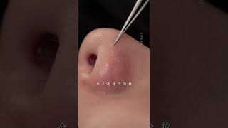 she came to quotcomfortquot her skin immersiveskincare blackheads asmr skinmanagement facialspa [upl. by Martsen]