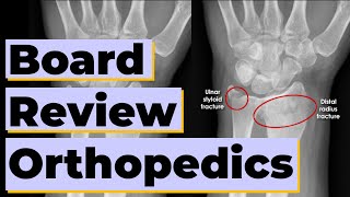 Emergency Medicine ITE Board Review Orthopedics [upl. by Nailij61]