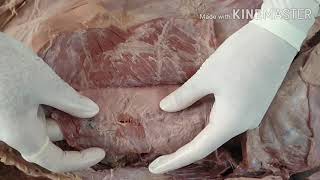 Dissection of Anterior Abdominal Wall by DrMeetu Agarwal [upl. by Ahsiea438]