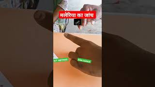 malaria test  malaria test slide method hindi [upl. by Farman]