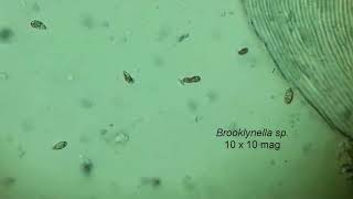 Aquaveterinarian Brooklynella microscopic ID [upl. by Erund]