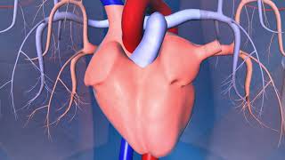 Implantable CardioverterDefibrillator ICD [upl. by Ellenet]