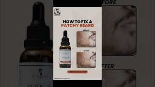 Want to fix a patchy beard 🧔‍♂️ beardcareroutine beardgrooming beardgoals [upl. by Zapot760]