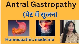 Antral Gastropathy पेट में सूजन treatment  Antral gastritis symptomscause amp homeopathic medicine [upl. by Lanctot]