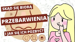 Rozjaśnianie przebarwień i blizn po trądziku  porady i kosmetyki [upl. by Nesahc843]