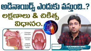 అడినాయిడ్స్ ఎందుకు వస్తుంది  Adenoids or Adenoid Hypertrophy Treatment  Dr Ramesh Babu ENT [upl. by Uhthna75]