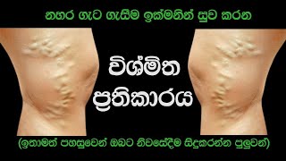 නහර ගැට ගැසීම ඉක්මනින් සුවකරන විශ්මිත අත් බෙහෙත  Best Home Remedy For Varicose Veins [upl. by Tnattirb]