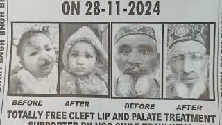 Free Cleft Lip amp Palate screening by SMILE TRAIN cleft centre Jammu at GMC Doda on 28th Nov 2024 [upl. by Anika328]