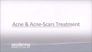 Mediderma Acne amp Acne Scar Treatment On ClickOnCare [upl. by Kristyn]