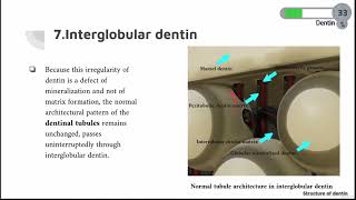 DENTIN COURSE  11  Intergolbular Dentin [upl. by Feigin]