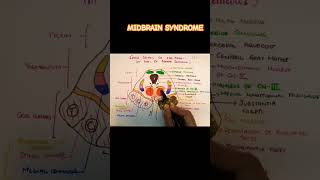 webersyndrome clinicalneuroanatomy midbrain [upl. by Varick993]