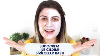 Sudocrem ile Yüzümü Sivilceler Bastı  SİVİLCE YAPAN KREM [upl. by Bili]