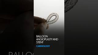 How is Balloon Angioplasty amp Stent Procedure Performed  Demonstration Inside Arteries [upl. by Zielsdorf]