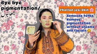 Melasma ka ilaj  Chehre ki Chaiyoon ka illaj  remove pigmentation [upl. by Anallij]