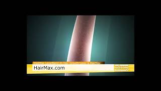 HairMax featured on Arizona Midday TV Gift Guide Holiday 2018 [upl. by Nehtanoj]