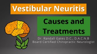 Vestibular Neuritis Causes and Treatment [upl. by Judson]