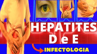 HEPATITE D e E  CARACTERÍSTICAS SINTOMAS DIAGNÓSTICO E TRATAMENTO  INFECTOLOGIA [upl. by Ecitnirp]