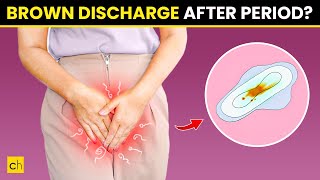 How To Stop Brown Discharge After Period  Causes amp Natural Remedies [upl. by Tedda]