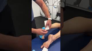 Taping for plantar fasciitis with Spidertech iStrips [upl. by Ecirtra]