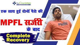 एक साथ दोनों पैरो की MPFL लिगामेंट सर्जरी  घुटने की कटोरी खिसकना  Knee cap or Patella Dislocation [upl. by Eslehc]