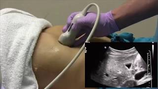 How I do it Ultrasound of the Abdomen [upl. by Wynnie]