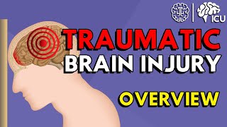 Overview of Traumatic Brain Injury TBI [upl. by Miru826]