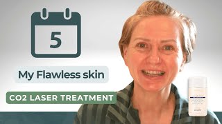 5 Days to FLAWLESS Skin with CO2 Laser Treatment [upl. by Stiruc]