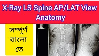 XRay LS Spine APLAT View Anatomy In Bengali [upl. by Maccarthy]