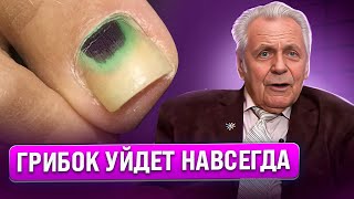 Неумывакин Грибки осыпаются сразу ногти молодеют достаточно одного [upl. by Mareah]