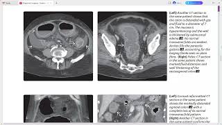 COLON DIAGNOSTIC IMAGING SERIES [upl. by Dorothi]