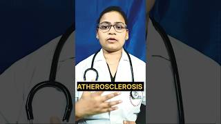 ATHEROSCLEROSIS bscnursing nursingeducation atherosclerosis aiims [upl. by Suoicul]