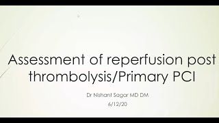 Assessment of reperfusion post fibrinolysisPrimary PCI [upl. by Dulla442]