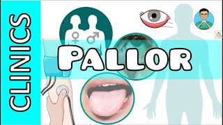 What is Pallor in Medicine  Where to Look for Pallor [upl. by Johansen]