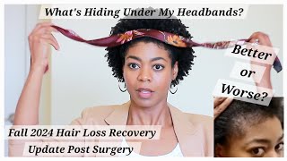 Whats Hiding Under My Headbands  Fall 2024 Hair Loss Update  4C Natural Hair  NaturalMe4C [upl. by Avevoneg583]