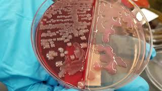 Microbiology Normal versus Pathogenic Bacteria in Urine Wound and Bite Cultures [upl. by Gianni109]