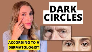 Can You Get Rid of Dark Circles Under Your Eyes Dermatologist Explains  Dr Sam Ellis [upl. by Harilda]