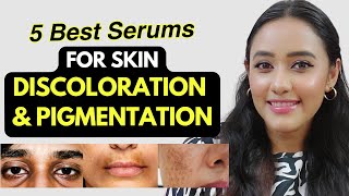 5 Best Serums for DISCOLORATION amp PIGMENTATION Serums to treat twotone skin amp get even skin tone [upl. by Sacttler]