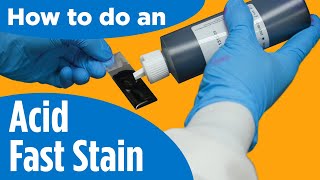 How to do an AcidFast Stain  Instructions for the labprocedure [upl. by Idisahc592]