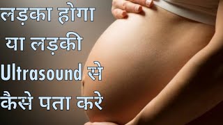 Anterior placenta  Posterior placenta Ultrasound से कैसे पता करे कि बेटा होगा या बेटी।। [upl. by Hashimoto]