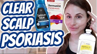 How to CLEAR SCALP PSORIASIS Dr Dray [upl. by Aniala]