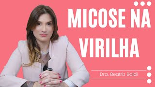 Micose na virilha  Dra Beatriz Franchito Baldi [upl. by Ahron74]