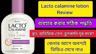 Lacto calamine face lotion reviewLacto calamine face lotion review in Bengali [upl. by Bridgid]