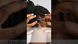 Scalp Care for Healthy Cornrows Essential Tips for Vibrant Braids [upl. by Paulo]