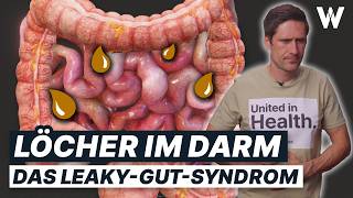 LeakyGutSyndrom  Durchlässiger Darm Kenne die Symptome und stärke Deine Darmgesundheit [upl. by Aldrich]