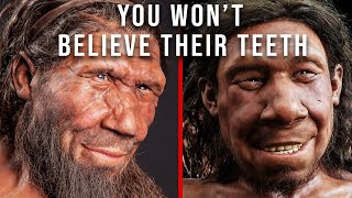 Cavemen had BETTER Teeth than You Here’s Why [upl. by Ranna138]