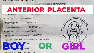 Anterior placenta baby gender  ultrasound scan report [upl. by Miguela]