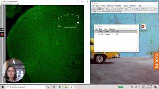 ImageJ  Densitometry using MAX projection image [upl. by Ariay]